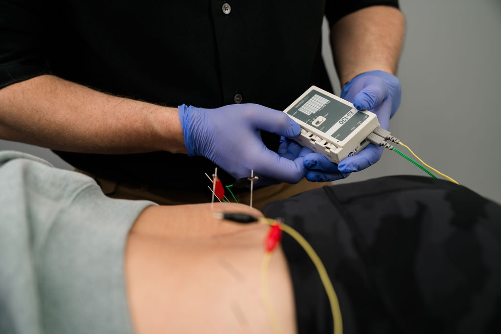 Integrative dry needling treatment at BeWell Physical Therapy
